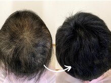 スーパースカルプ 大橋駅前店(Super Scalp)の雰囲気（大橋駅/痩身/ヘッドスパ/毛穴/マッサージ）