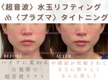 ルミエール(Lumiere)