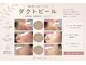 シュシュ(chouchou)の写真