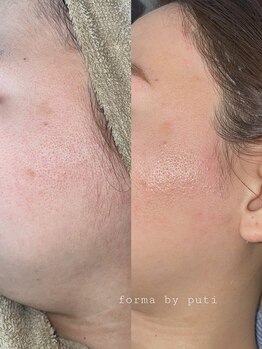 フォルマ バイ プティ(forma by puti)/フェイスWAX