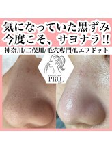 エフドット(f.)/毛穴美人コース