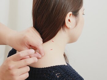 星の鍼灸接骨院