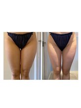 ルナグランデ 心斎橋店(Luna grande.)/タイトなお洋服も楽しめる