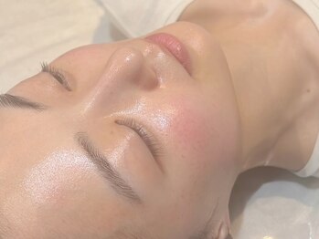 ヨハク 市川店(yohaku)/ハーブピーリング