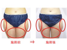 東京美容整体/ダイエット痩身 40代女性