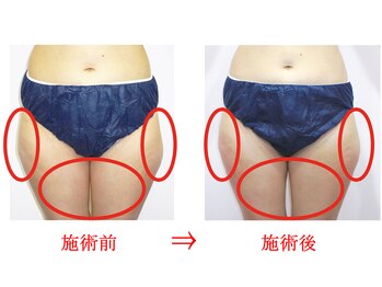 東京美容整体/ダイエット痩身 40代女性