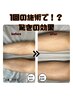★新クーポン★クチコミ投稿必須★メンズ脱毛全身(顔・VIO込み)¥39,000→