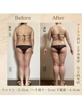 エソール(essor)/本格痩身1ヶ月でこの変化！