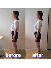 アンドリノ(&Lino)/姿勢改善・美容矯正