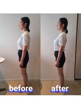 アンドリノ(&Lino)/姿勢改善・美容矯正