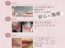 ビューティーリバース 湘南ちがさき店/ローマピンクとは２