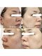 エミフル(emifull)の写真/【肌がキレイって言われるようになりました】シミ シワ たるみ くすみ トラブル肌等お肌のお悩みを根本改善