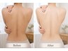 【全身の紫外線ダメージケア】ボディ　フォト光全身 50000円→11000円 &nbsp;