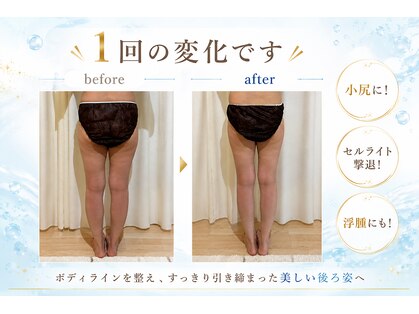 ヨサパーク ベル 福工大前店(YOSA PARK Belle)の写真