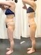 パラディ(PARADIS)の写真/【40代からの落ちないお腹に】ハイパーナイフ×ハイパーシェイプの集中痩身