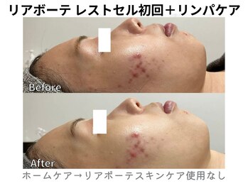 リライン(ReLine)/【レストセル+リンパケア】