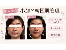 東京オンダリフト 恵比寿店の雰囲気（小顔リフトでフェイスラインすっきり◎二重顎・たるみ・むくみに）