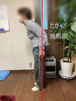 たか施術院/《姿勢矯正》猫背　腰痛