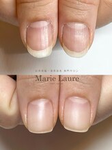 マリーロール 梅田店(Marie Laure)/自爪育成/深爪矯正/ネイルケア