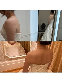 ディア スプリーマ/ブライダルエステ★二の腕細く