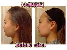 アットティービューティー 金沢文庫店(at tee...beauty)/【小顔矯正】金沢文庫attee...