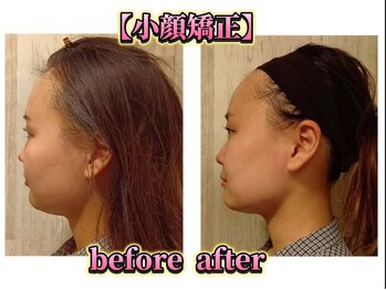 アットティービューティー 金沢文庫店(at tee...beauty)/【小顔矯正】金沢文庫attee...