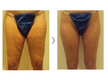 まごころ整体院/痩身