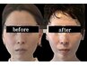 【鏡をみて落ち込む日を終わらせたいあなたへ】半年後に驚かれる顔作り体験！