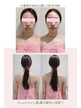 トゥインクル 麻布(twinkle)/港区/小顔矯正/ブライダルエステ