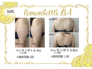 アヤエステティックサロン 綱島店(AYA)/《痩身.5》【綱島/エステ】