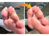 【つらい足裏の痛みに】角質ケア+フットマッサージ90分 11000円→9900円