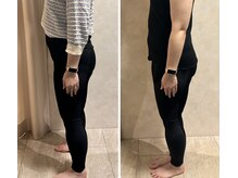 オーパーツ(OOPARTS)/血流ケアの美肌&ダイエット