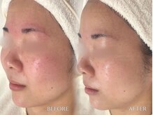 ジェム(gemme)/UNSTRESS／アンストレス