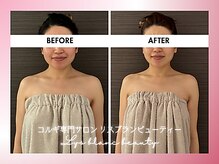 リス ブラン ビューティー(Lys blanc beauty)/９０分コルギBefore×After