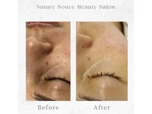 ナチュラ ソース(NatureSouce)の雰囲気（毛穴レス&お肌もワントーンUPしうるうるに◎（毛穴/肌管理））