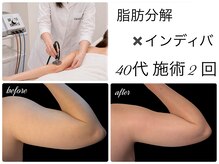 エルール トータルビューティ(Aileure total beauty)