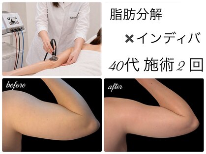 エルール トータルビューティ(Aileure total beauty)の写真