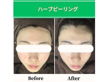 ヘアティブ アンド スキンベイビー 名古屋金山店(Hairtive&Skin Baby)