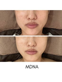 リムビューティー 自由が丘(RymBeauty)/マドンナがプロデュース