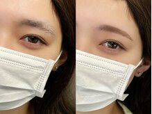 チルアンドアイ 千葉駅前店(Chill&Eye)/美眉スタイリング/BeforeAfter