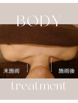 ルポ(repos)/1回でここまで変わる