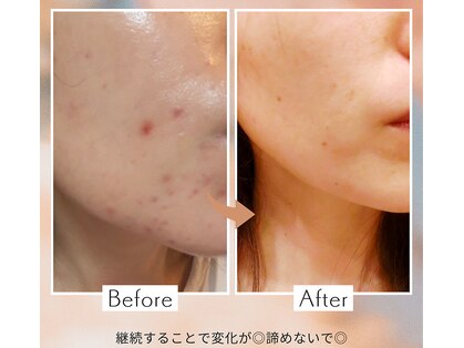 プラスオン(plus ON)の写真