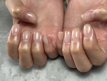 京都 パラジェル フィルイン