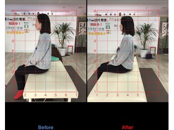 ストレチックス 近江八幡店/BeforeAfter