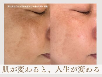 アンティアージュ 黒崎サロン(antiage)