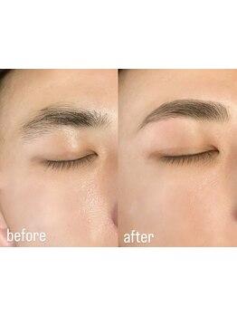 メンズフェイシャル