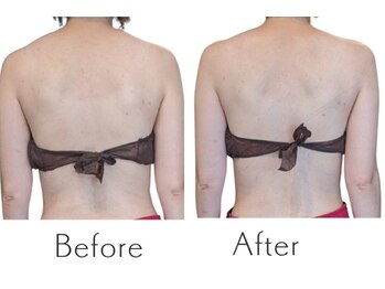 こりとり名人の写真/歪みは、見た目の印象を大きく左右します☆立ち姿から、印象を整え、バックラインに自信が持てるように☆