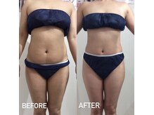 エスグレース 梅田店(S.grace)/最新痩身技術でお腹撃退！