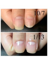 アマランサス(Amaranthus)/美爪最強ネイルケア