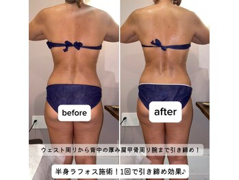 久遠(kuon)/上半身痩身&ボディメイク術♪